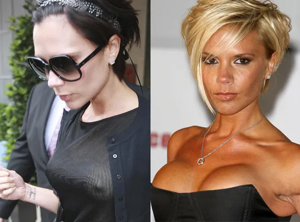 Oto kobiety, które chcą zmniejszyć biust