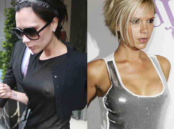 Burzliwa historia biustu Victorii Beckham