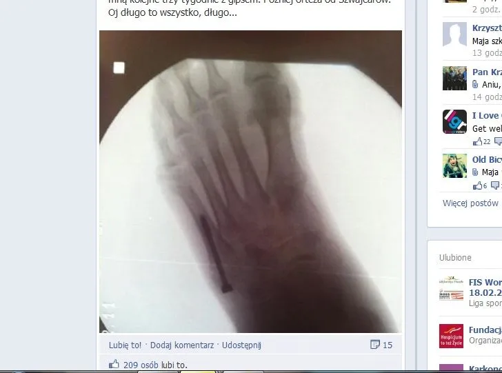 Stopa Mai Włoszczowskiej