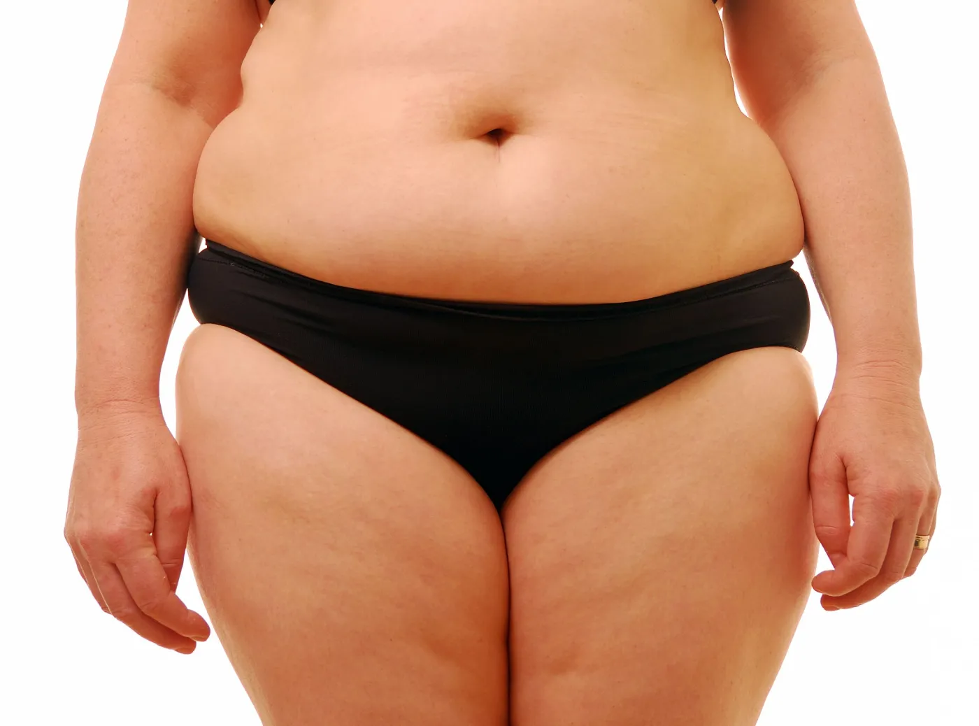 otyłość otyła gruba brzuch tłuszcz