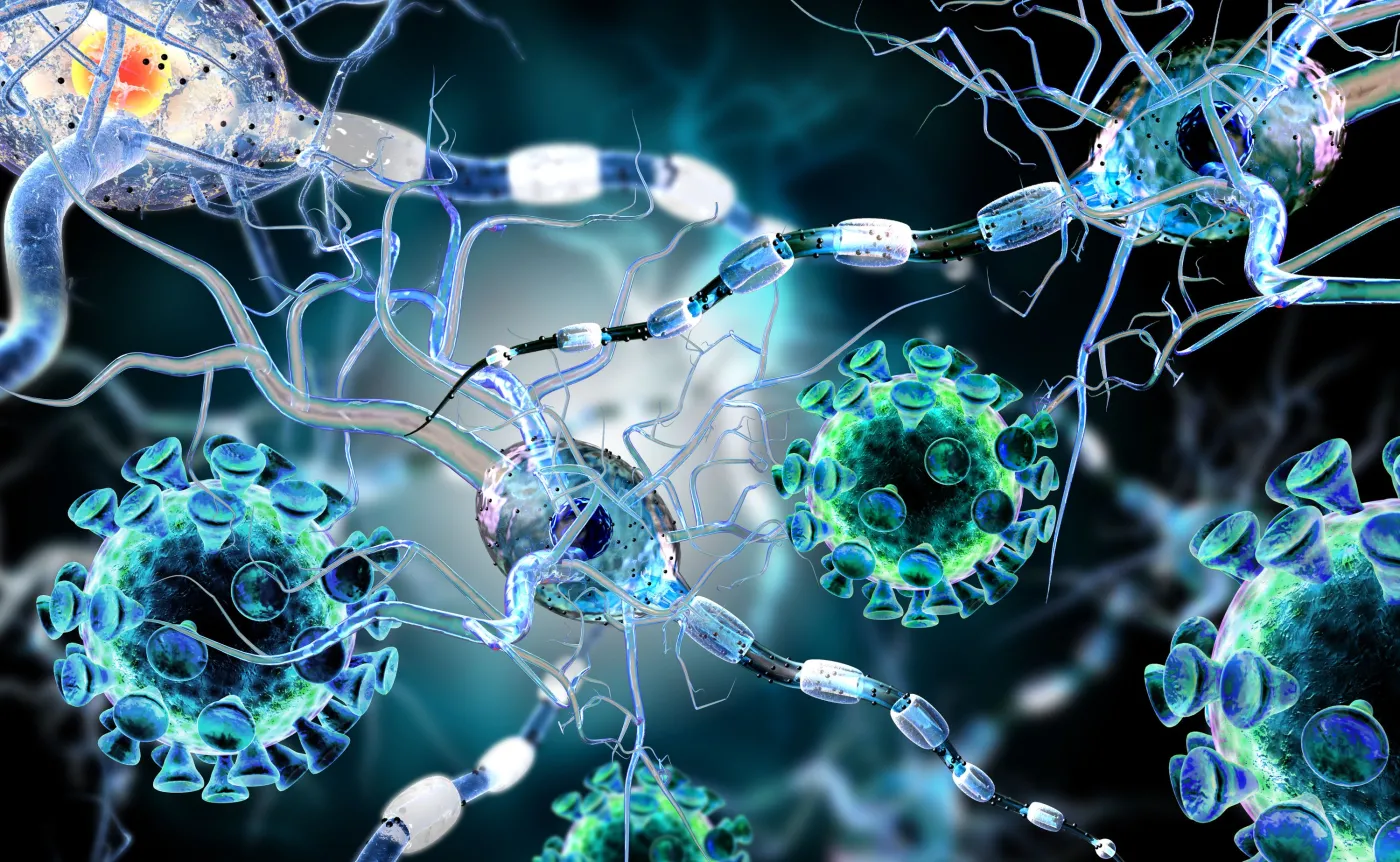 Choroba układu nerwowego