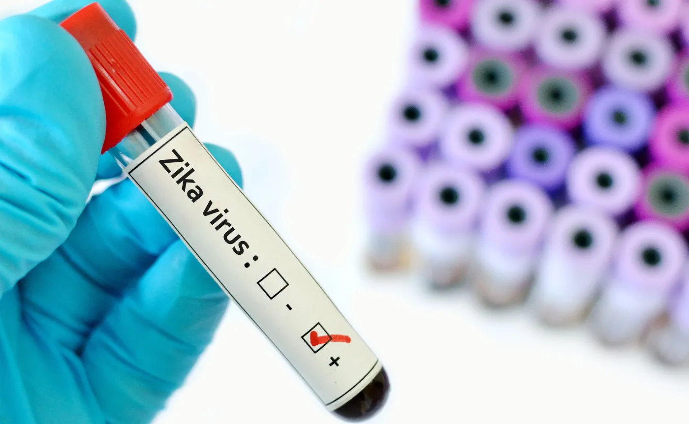Krew zakażona wiruse Zika