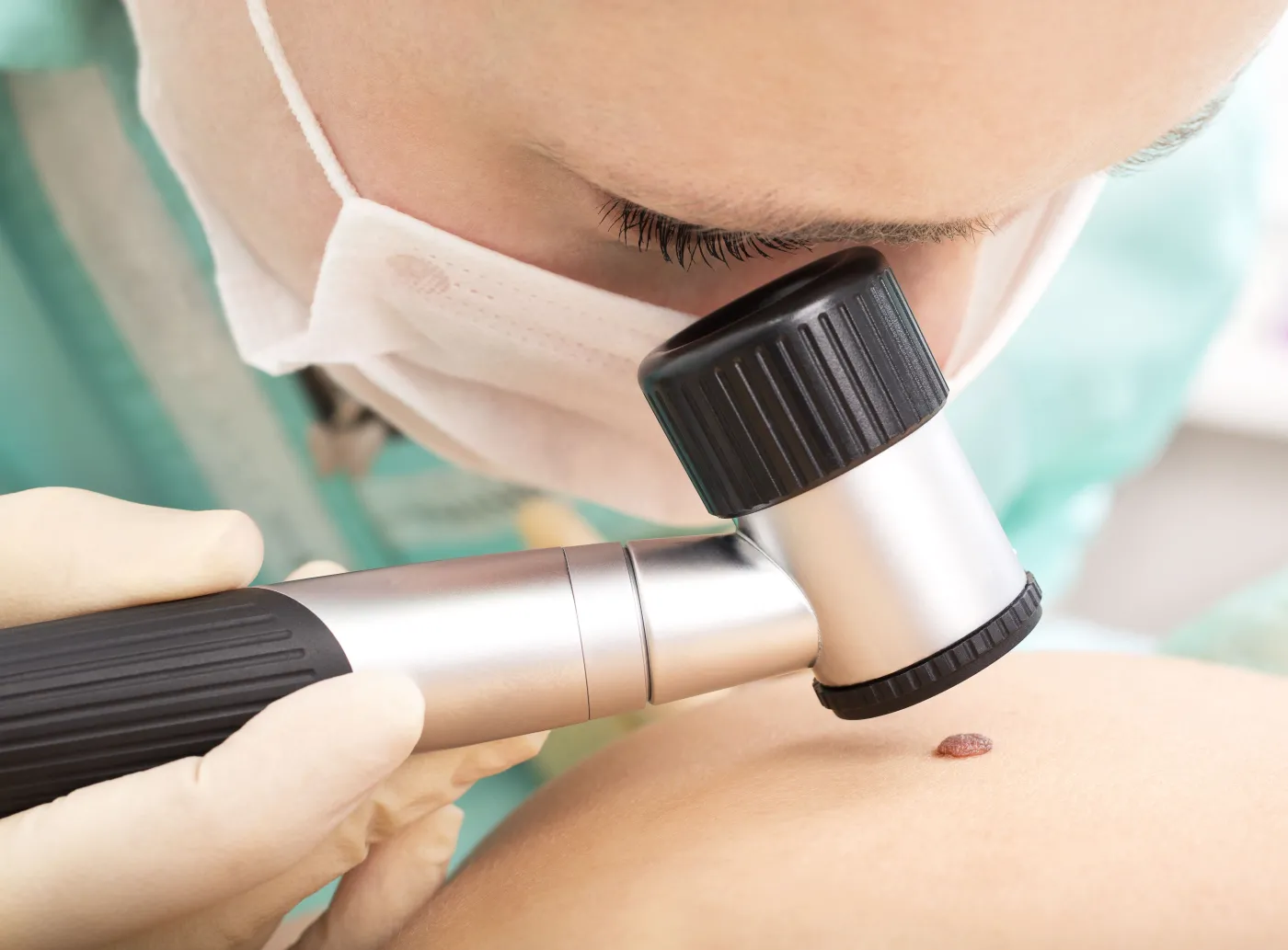 Badanie zmiany na skórze