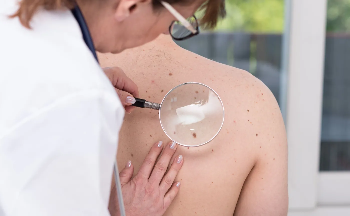 Dermatolog ogląda skórę