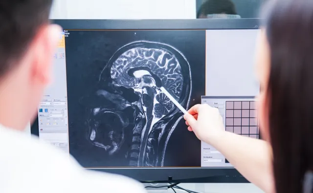 Polski pomysł, jak zablokować rozwój padaczki po udarze lub urazie