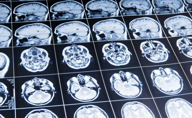 Długi pobyt w kosmosie wpływa na mózgi astronautów. Jak bardzo?