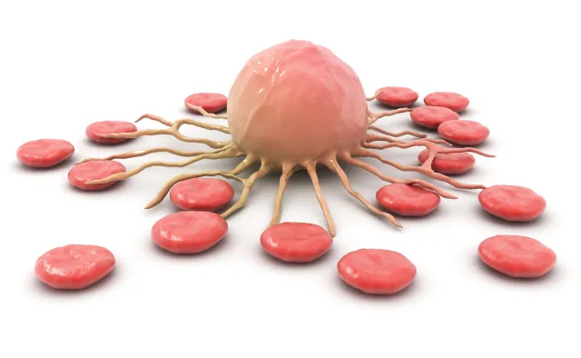 Zespoły mielodysplastyczne - mało znany nowotwór krwi. Częstszy niż białaczka