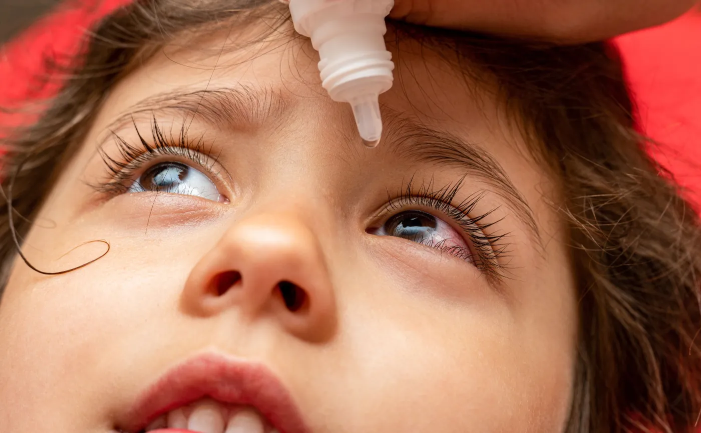 Zakraplanie oka dziecku, krople do oczu