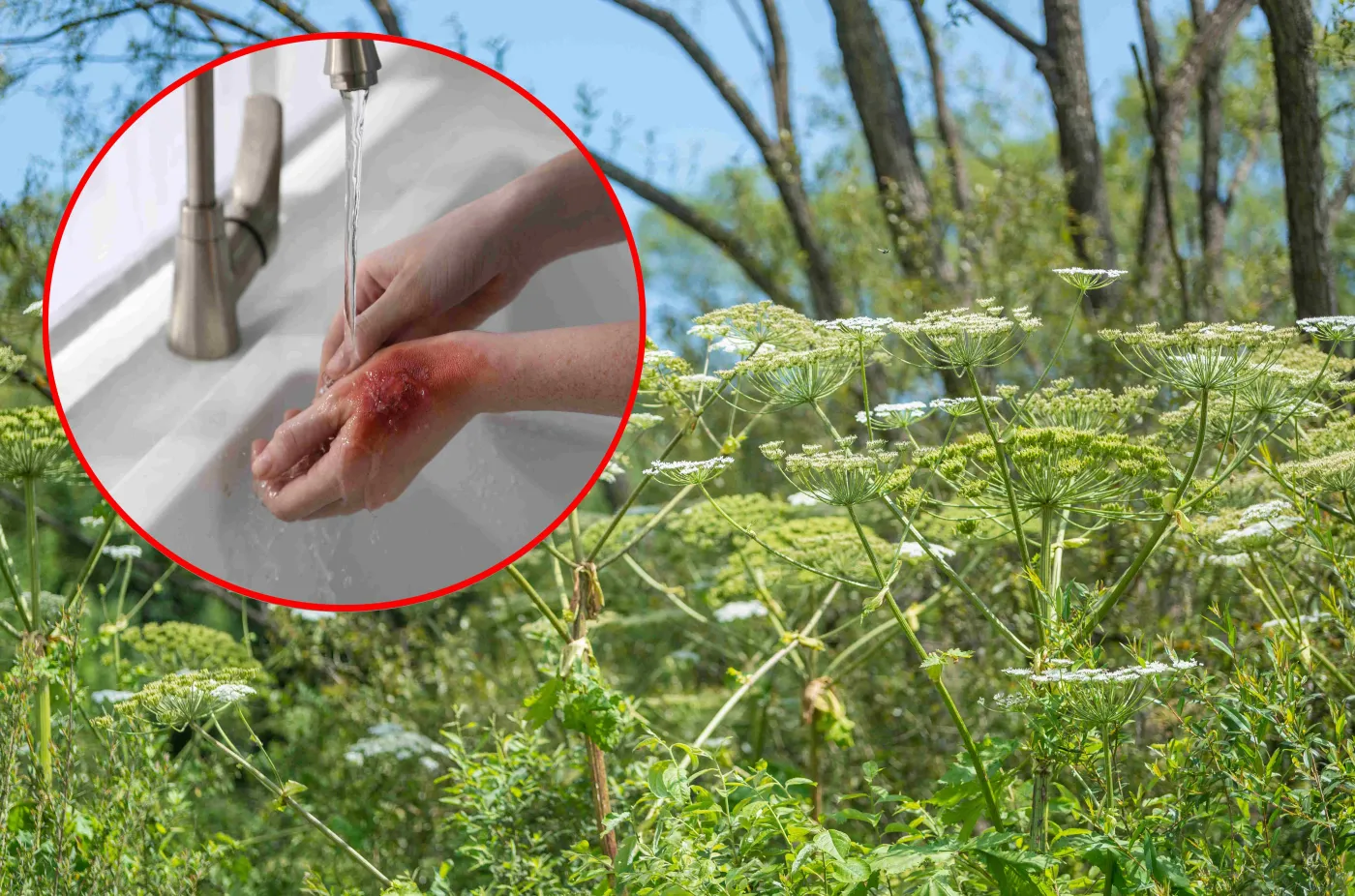 Barszcz Sosnowskiego to wyjątkowo niebezpieczna roślina. Gdy ją zobaczysz zgłoś to do Straży Miejskiej