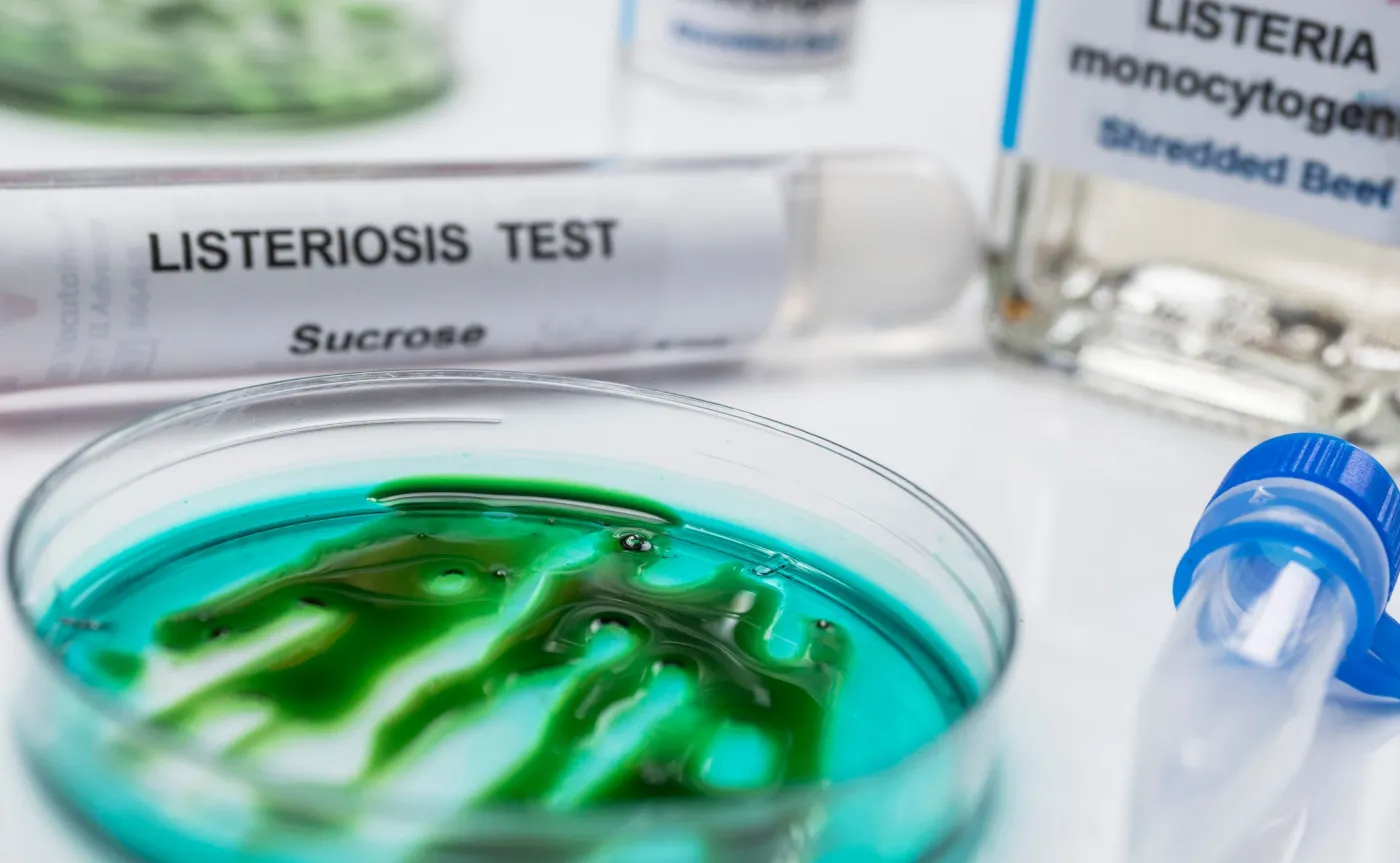 Listerioza, listeria monocytogenes