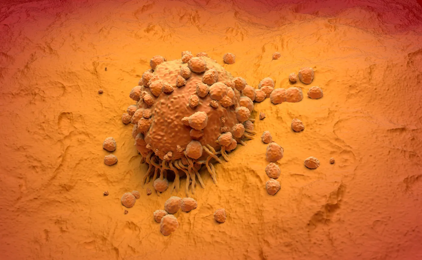 Czerniak, rak skóry