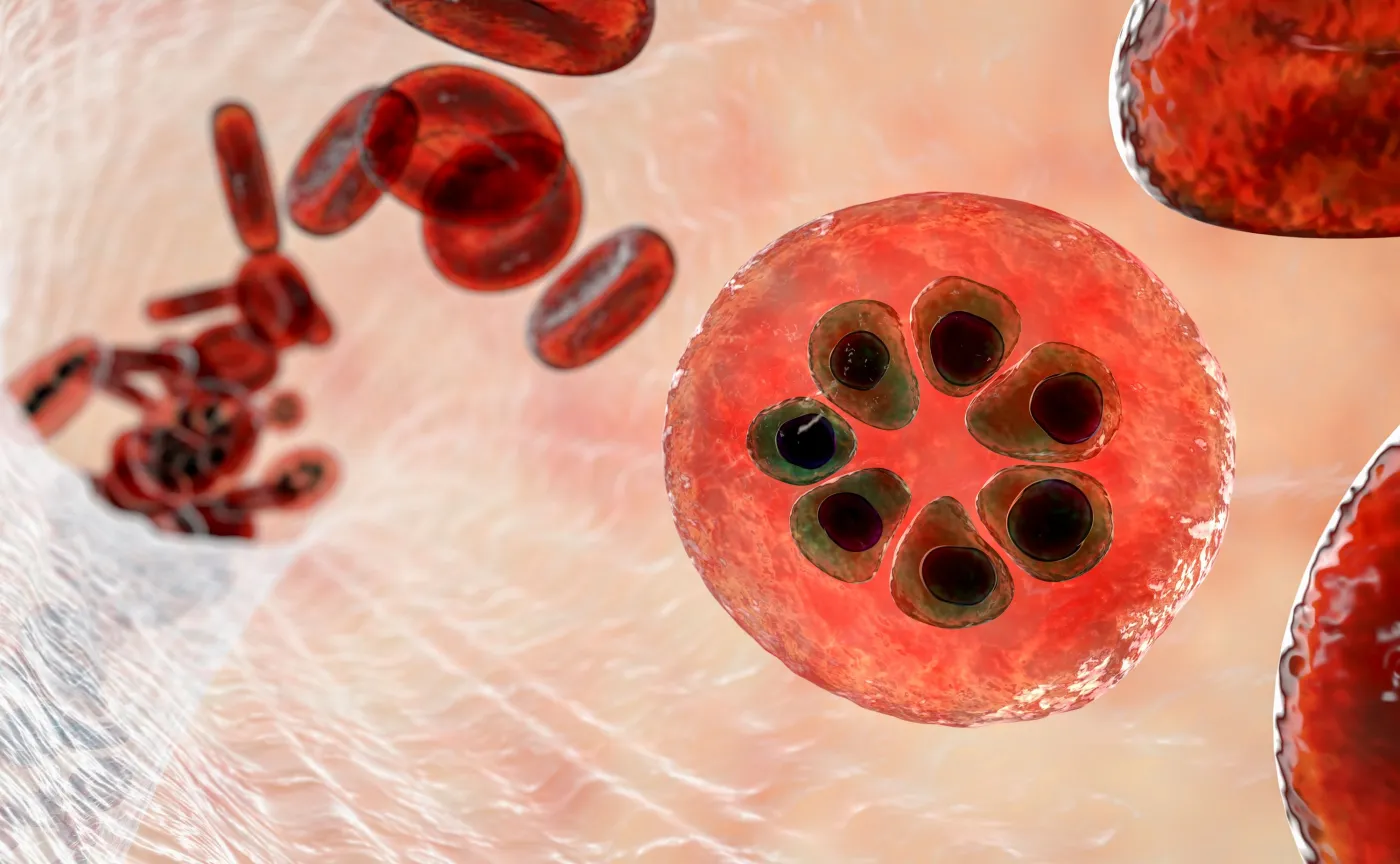 Zakażenie malarią, malaria, Plasmodium malariae