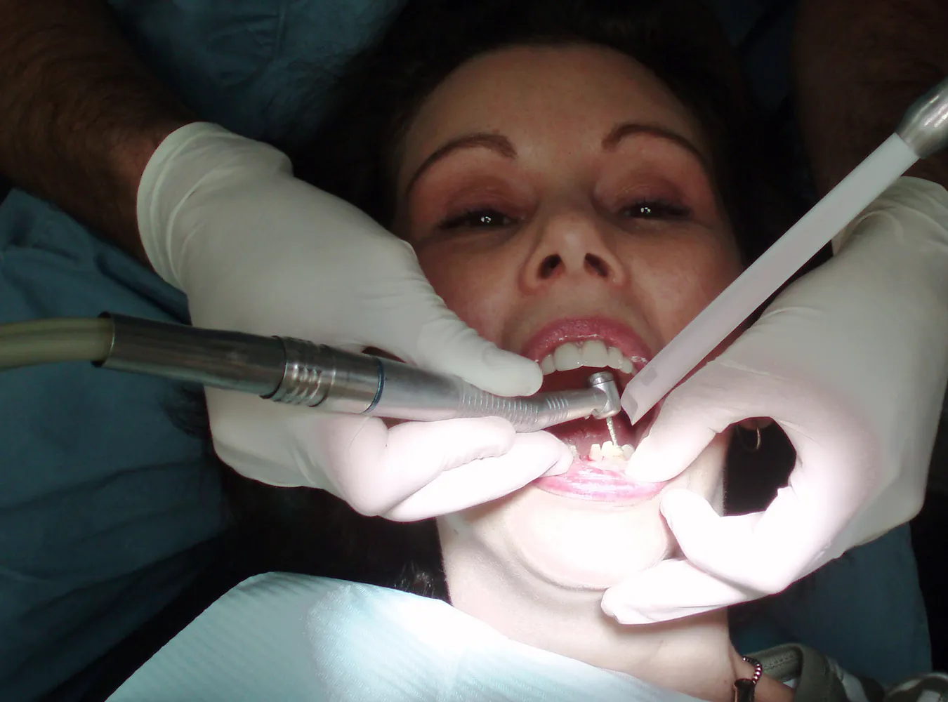 Niedługo tę usługę zrobisz u dentysty za darmo. Chodzi o skutki wypadków