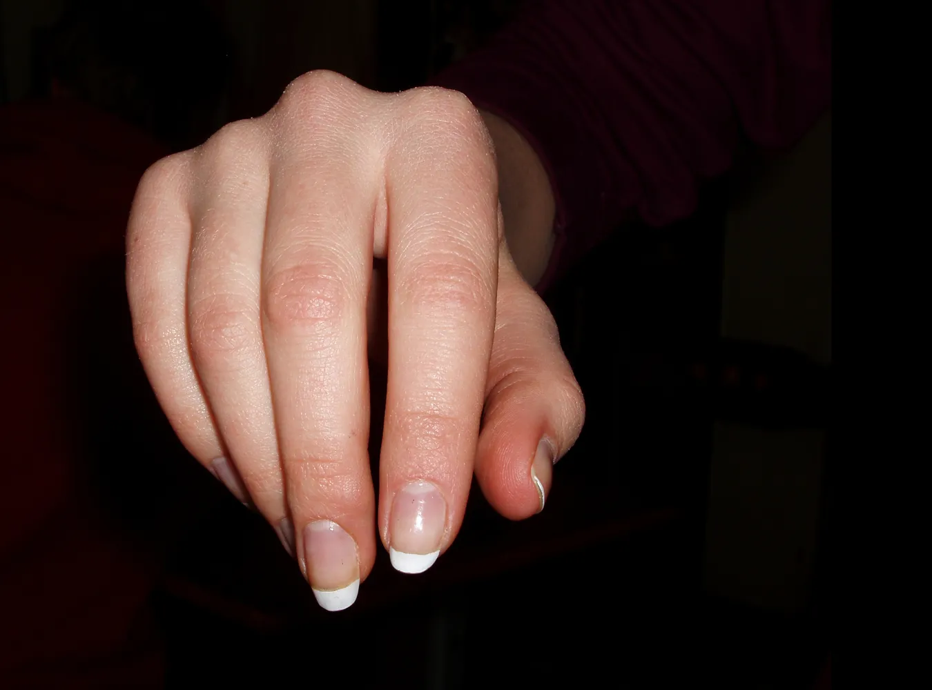 Drapanie się naprawdę pomaga na swędzenie