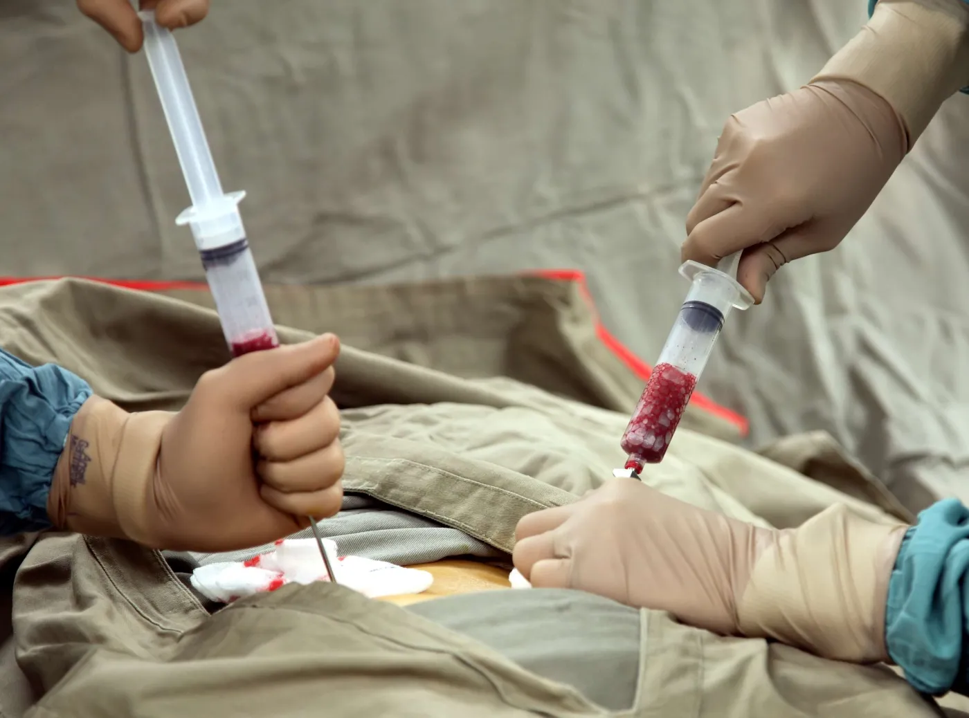 operacja szpik kostny komórki macierzyste