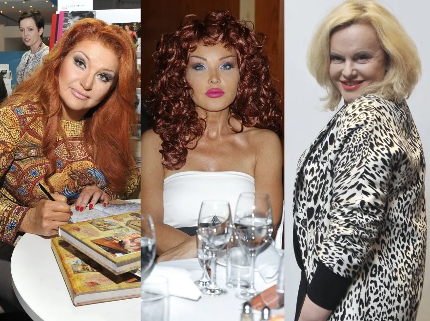 Najsztuczniejsze twarze w polskim show-biznesie