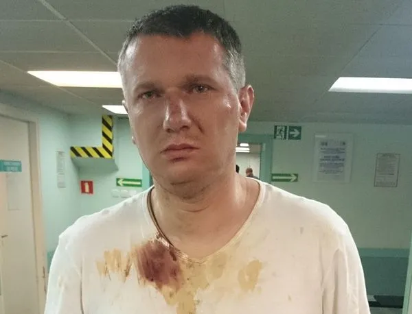 Nie tylko Wipler. Niedyspozycja czy rausz? Politycy na gazie. ZDJĘCIA