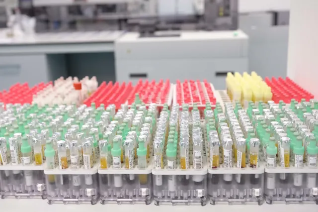 Włosi przeprowadzili najwięcej testów w przeliczeniu na liczbę mieszkańców