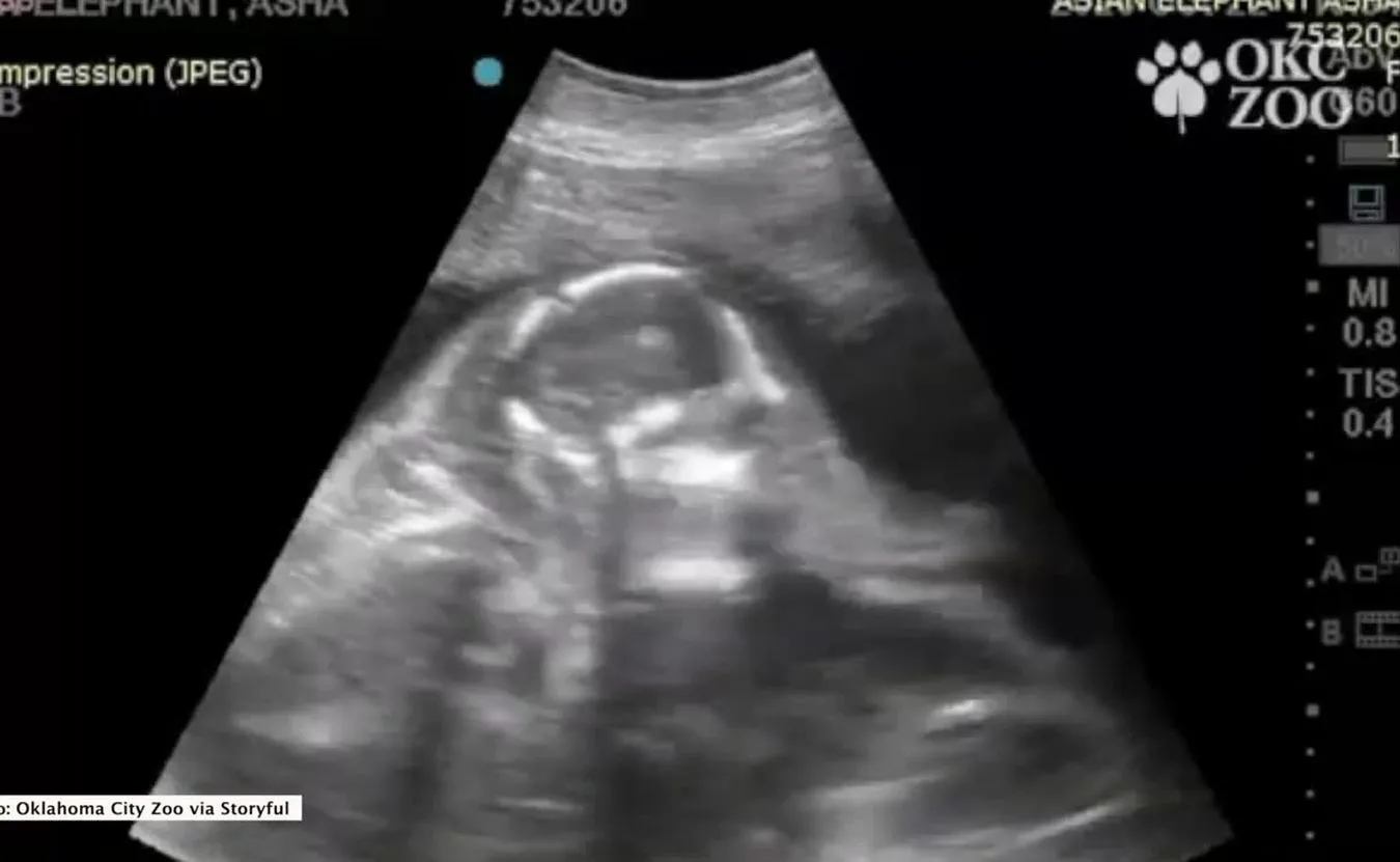Oto mały słonik w brzuchu mamy. Takiego USG nie widzi się często! [WIDEO]
