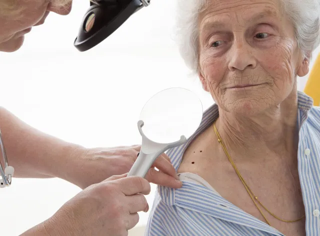 Wyniki leczenia czerniaka są najgorsze w starszych grupach wiekowych