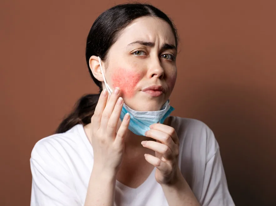 Słowo-klucz: delikatność. Oto, jak należy dbać o cerę z trądzikiem różowatym