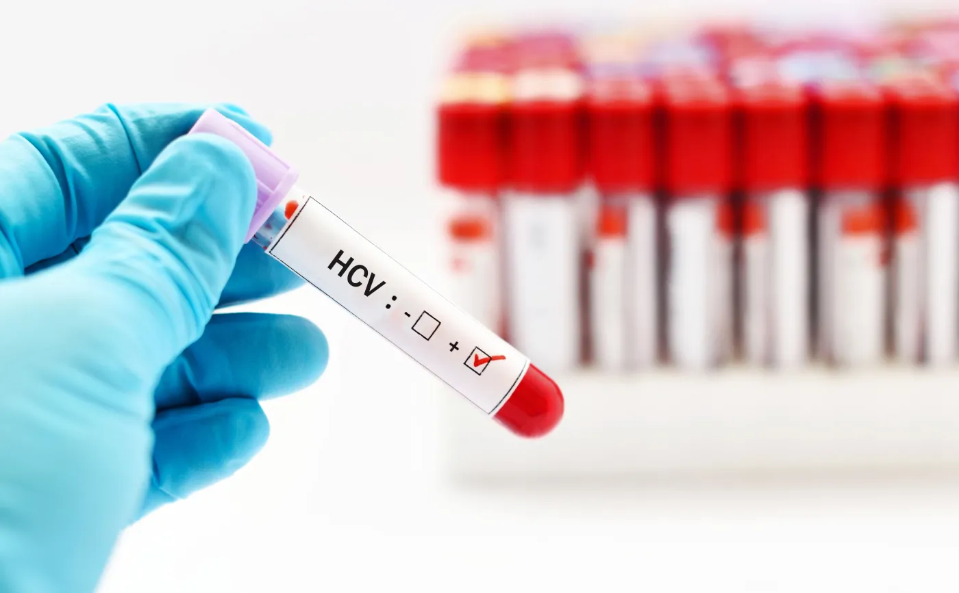 Lekarze rodzinni mogą kierować na badanie wykrywające zakażenie wirusem HCV