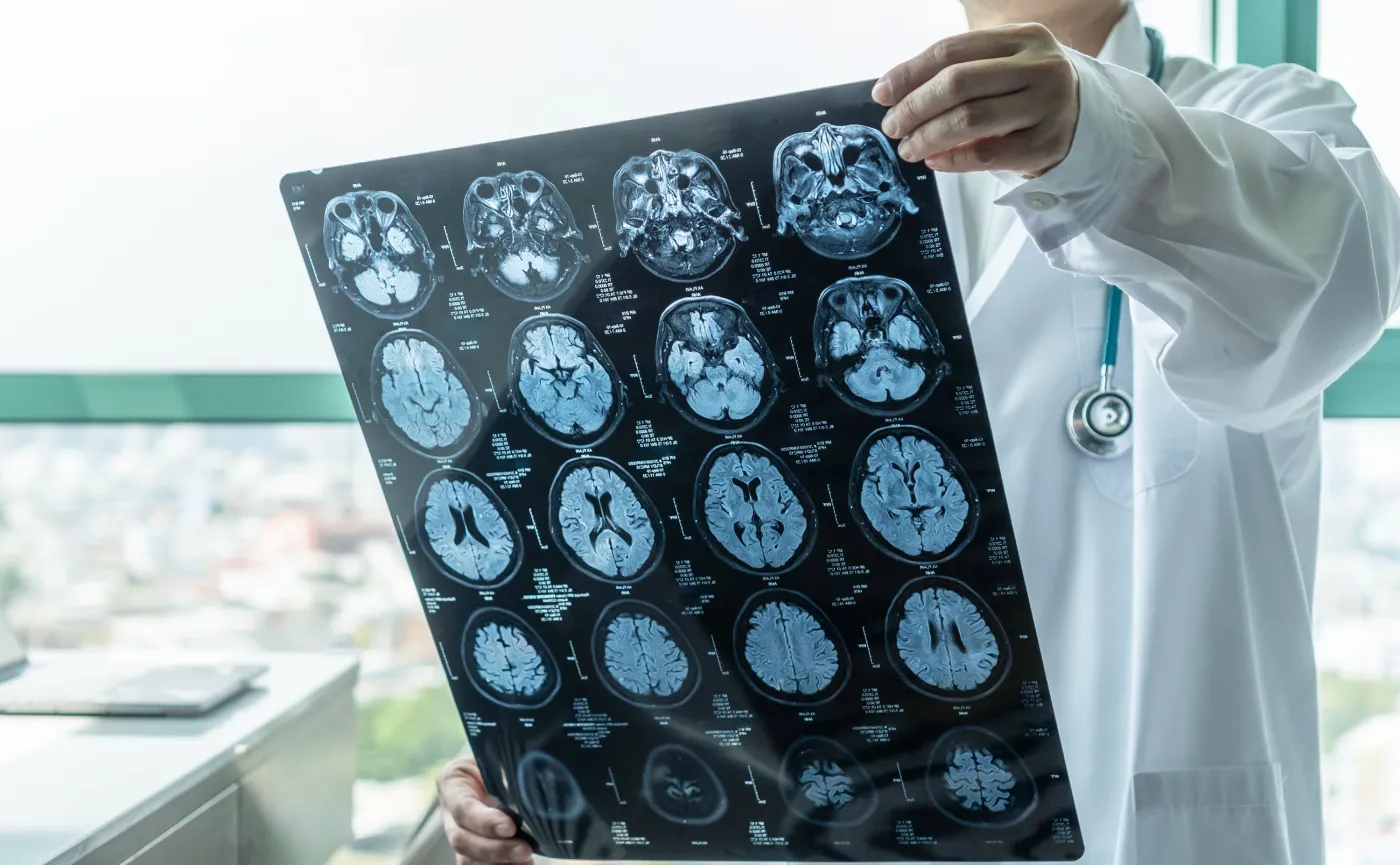 Ciepła woda poprawia wynik operacji krwiaka wewnątrzczaszkowego