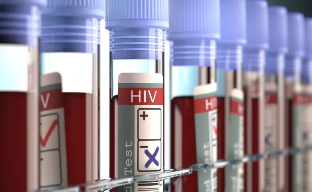 Musimy traktować test na HIV jak morfologię. Liczba zarażonych stale rośnie