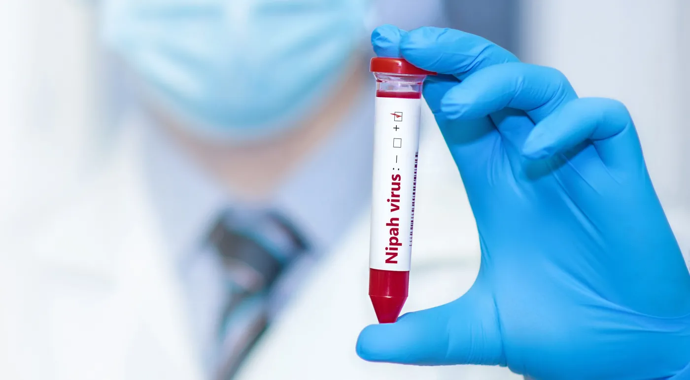 Kolejne zakażenia wirusem Nipah. To jeden z najbardziej śmiertelnych wirusów świata. Ma "potencjał pandemiczny"