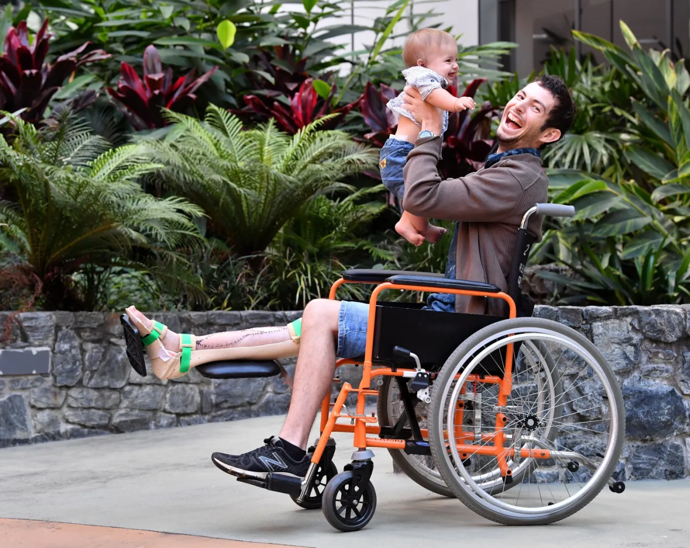 Stracił kość przez zakażenie. Lekarze wydrukowali mu nową