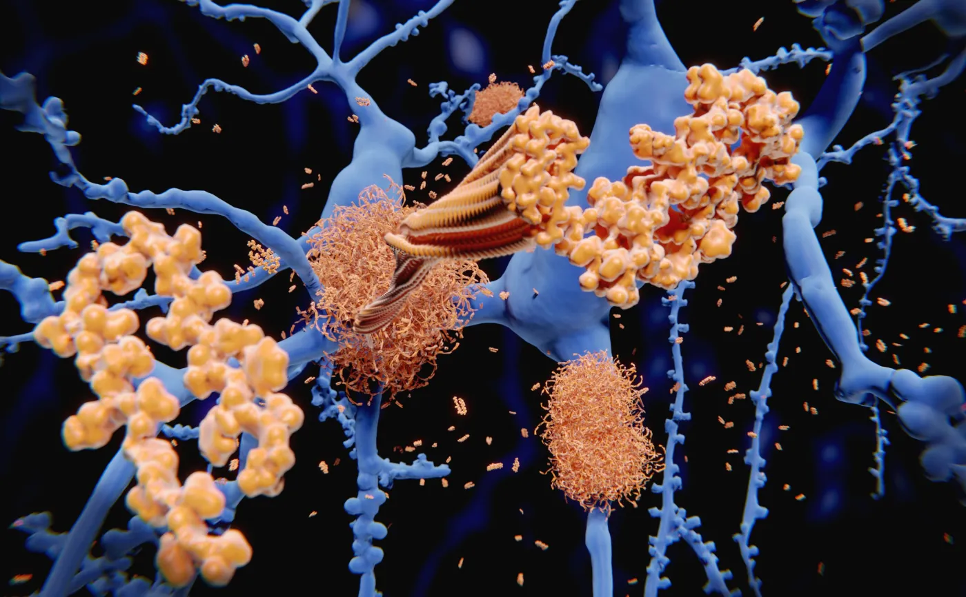 Uszkodzenia komórek nerwowych w mózgu