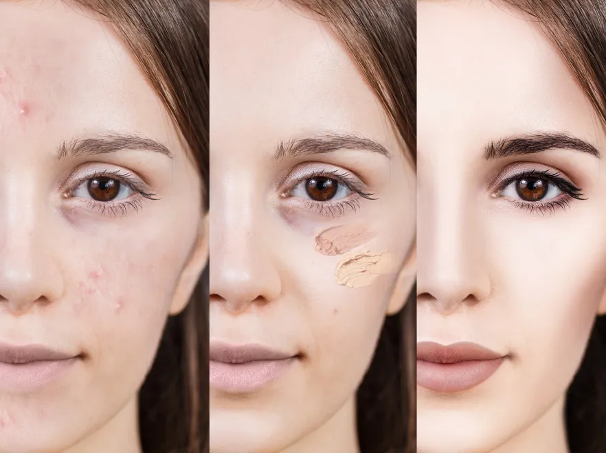 Doskonałe triki na zakrycie makijażem niedoskonałości cery