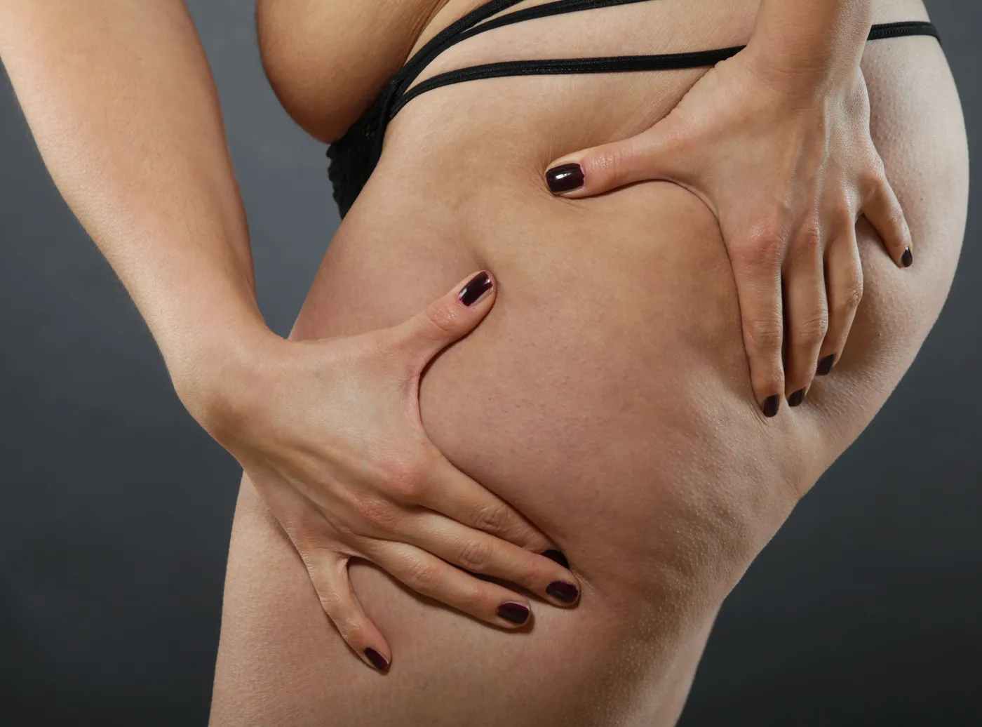 nadwaga otyłość cellulit grube udo