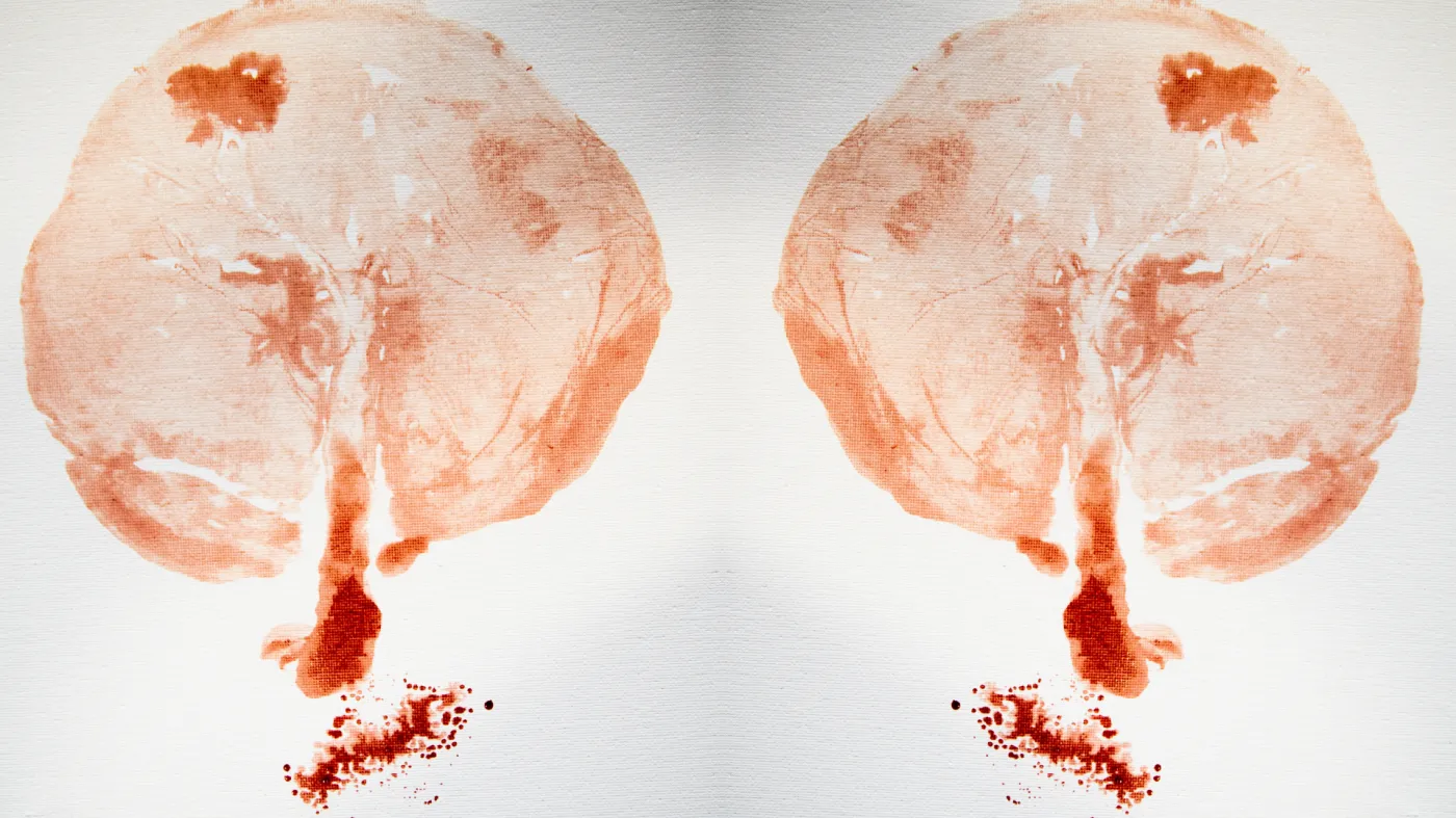 Placek o niesamowitych właściwościach. Poznaj 4 fakty o łożysku