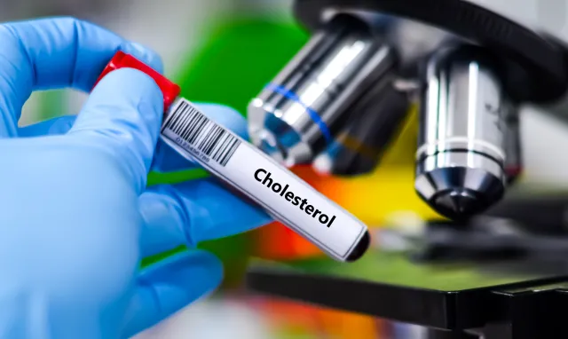 Nowe wytyczne dotyczące cholesterolu 2026 – co zmienia się w profilaktyce chorób serca?