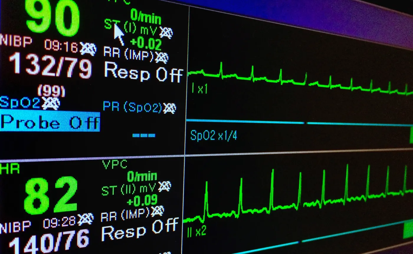 Monitor do badania pracy serca