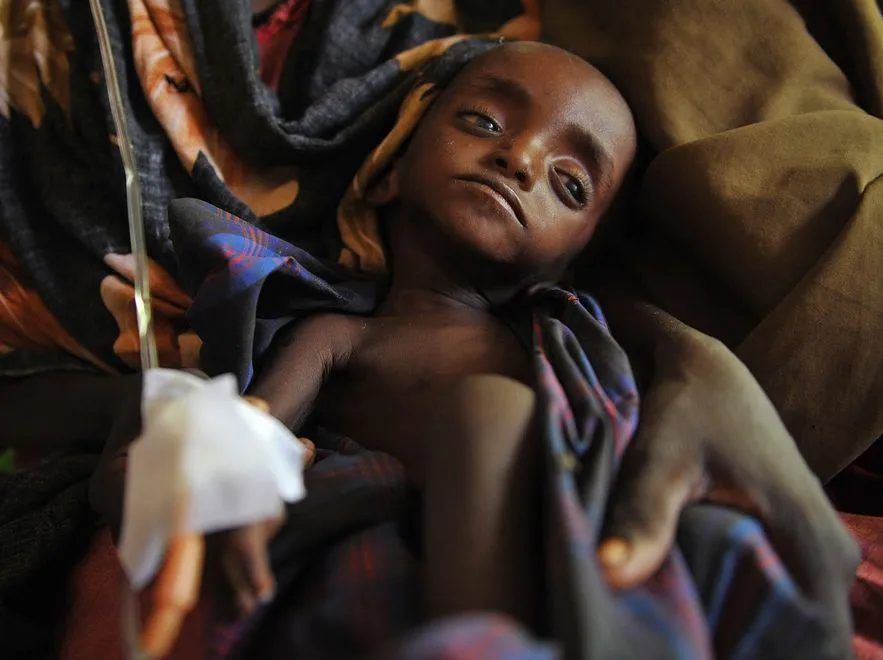 2900150-skrajnie-niedozywione-somalijskie.jpg