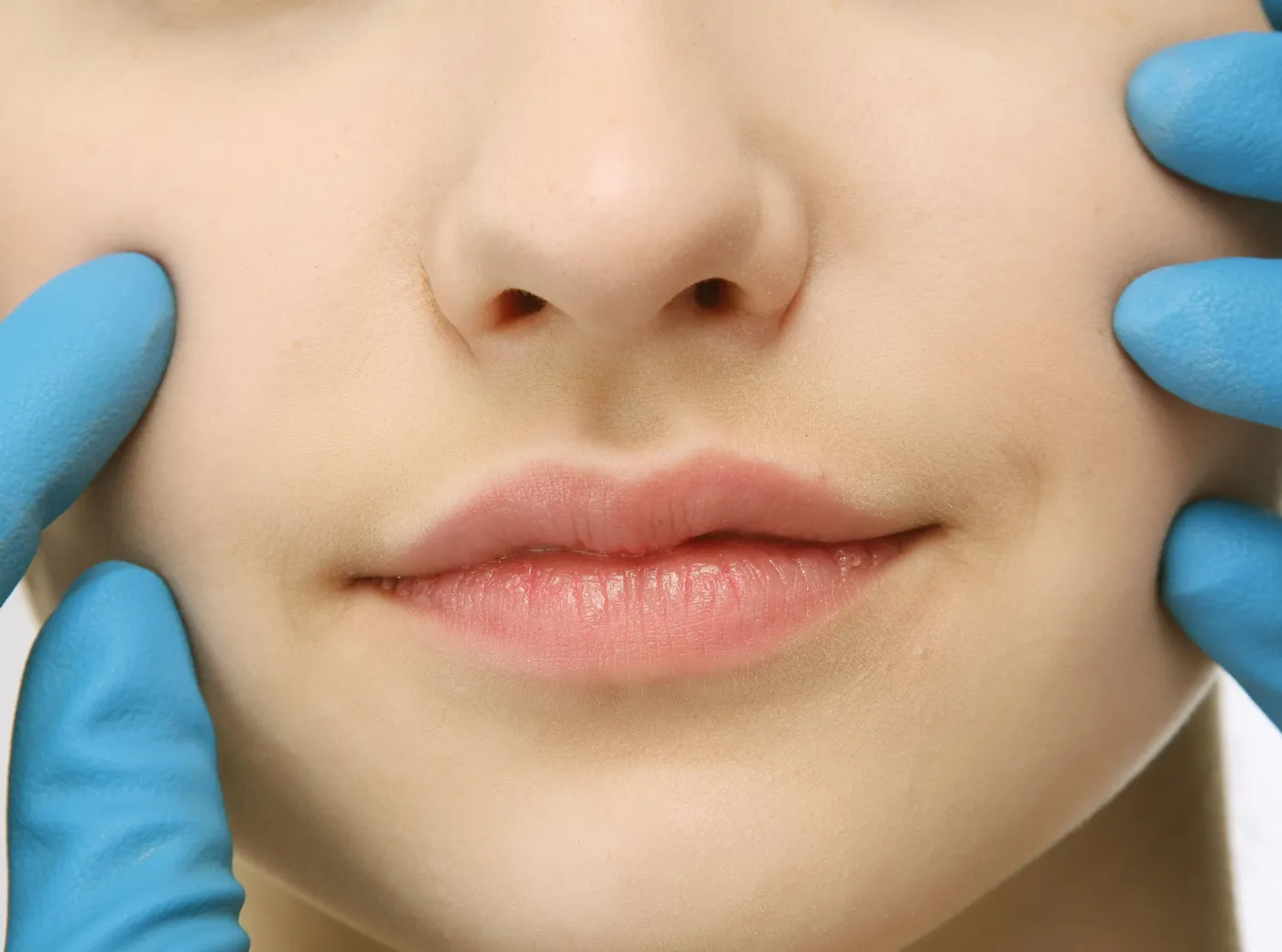 chirurg operacja plastyczna twarz kobiety