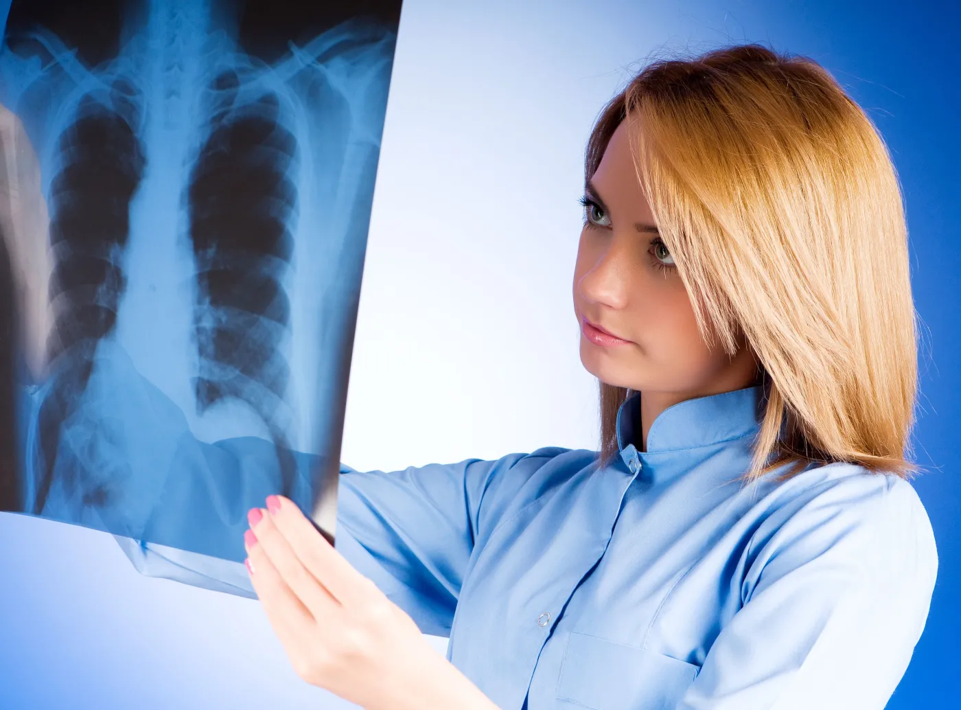 płuca rentgen rtg doktor pulmonolog lekarz prześwietlenie