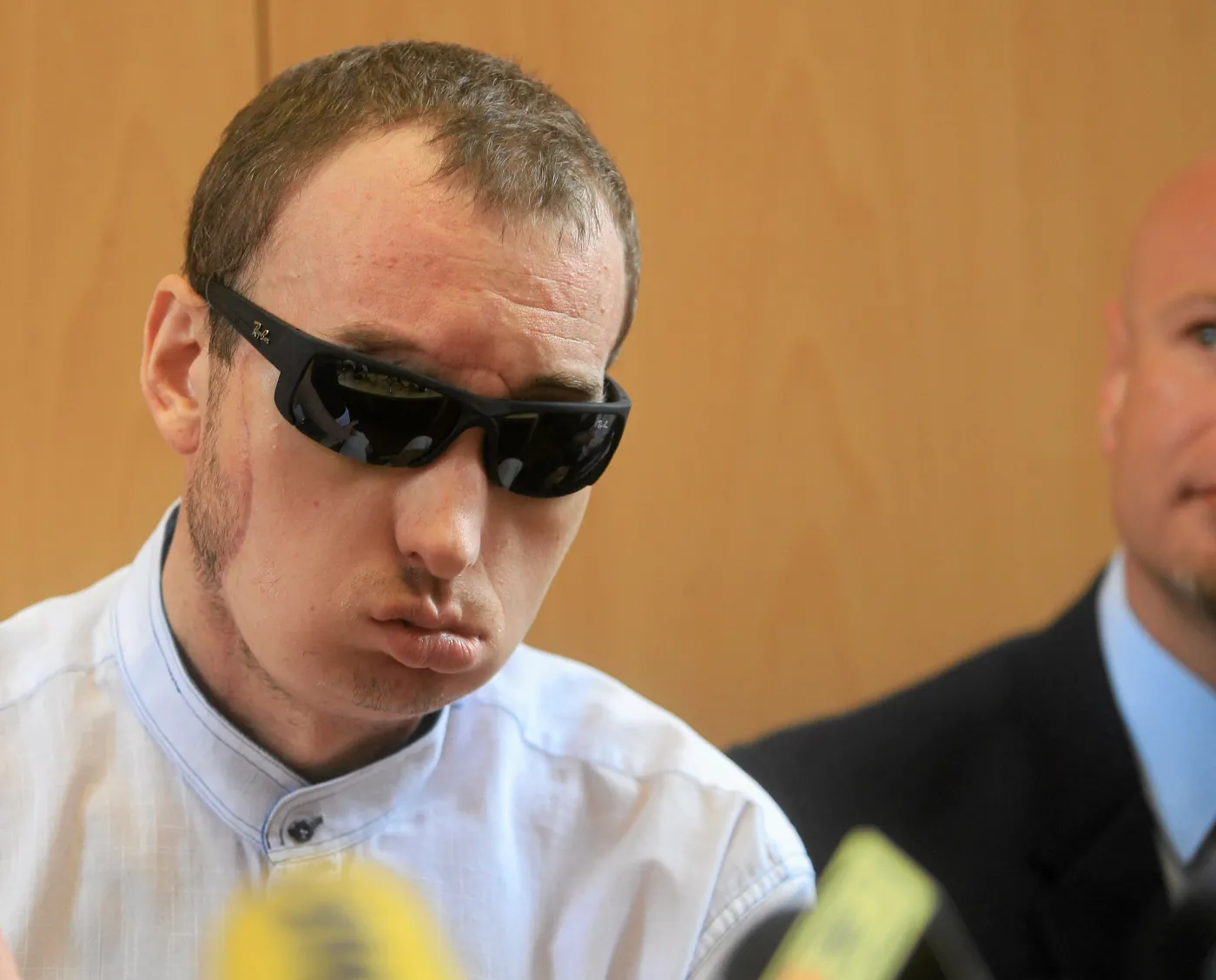 Pacjent, który przeszedł rewolucyjny przeszczep twarzy