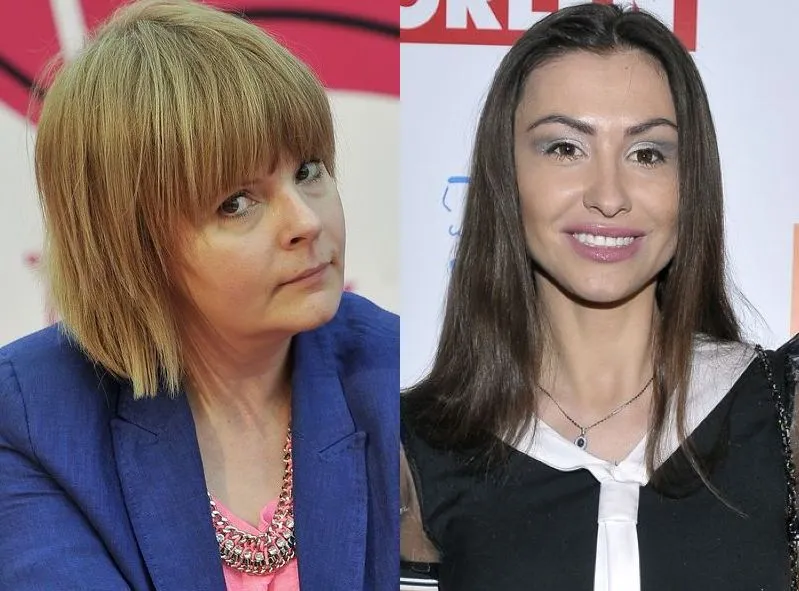 Dziennikarka ostro o celebrytce: Klientka niewidomego chirurga plastycznego