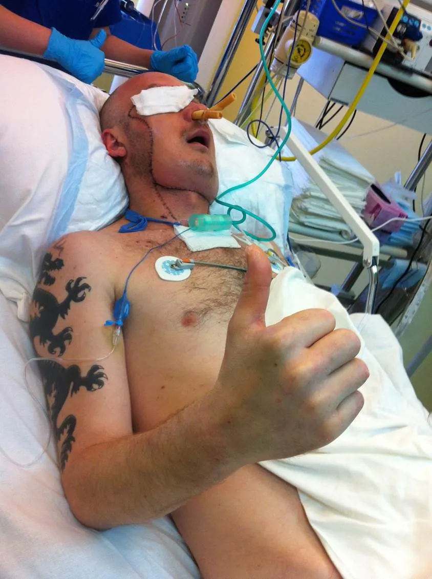 Pierwszy przeszczep twarzy w Polsce. Centrum Onkologii w Gliwicach