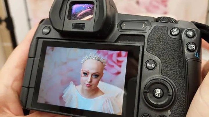 Niezwykła sesja "Onko Piękni". Na zdjęciach dziewczyny z oddziału hematologii