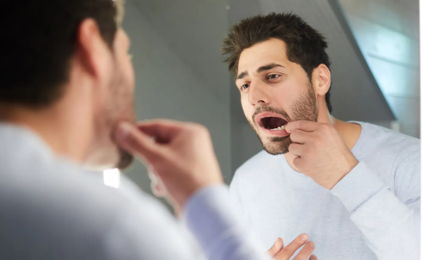 Wygląda groźnie, ale czy to poważny problem? KRWIAK w jamie ustnej