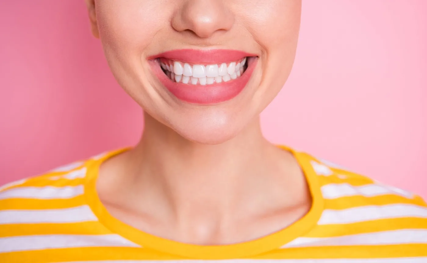 Spektakularny efekt pięknych zębów: LICÓWKI. Jak działają i dla kogo dobre?