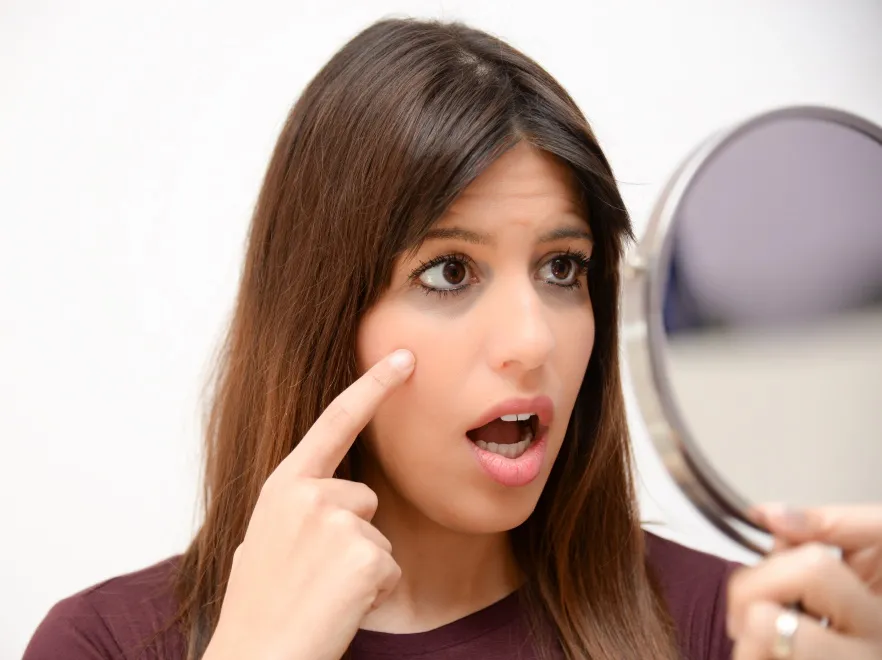 Domowe sposoby na cienie i worki pod oczami. To działa!