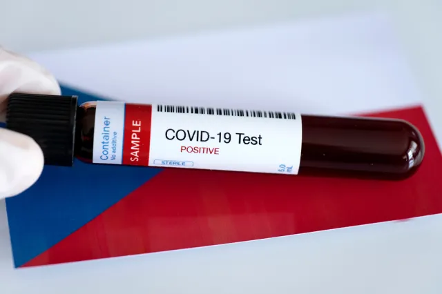 Czechy proszą Izrael o pomoc w organizacji szczepień