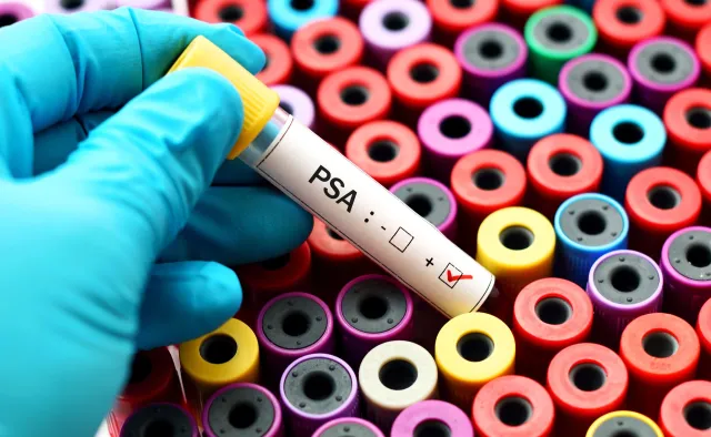 Eksperci: Pacjenci coraz częściej zgłaszają się z bardziej zaawansowanymi nowotworami