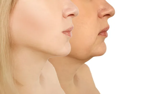 Odmładzanie bez bólu. Na czym polega mezoterapia próżniowa?