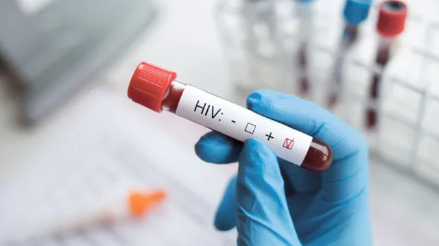 Nie bójmy się testować